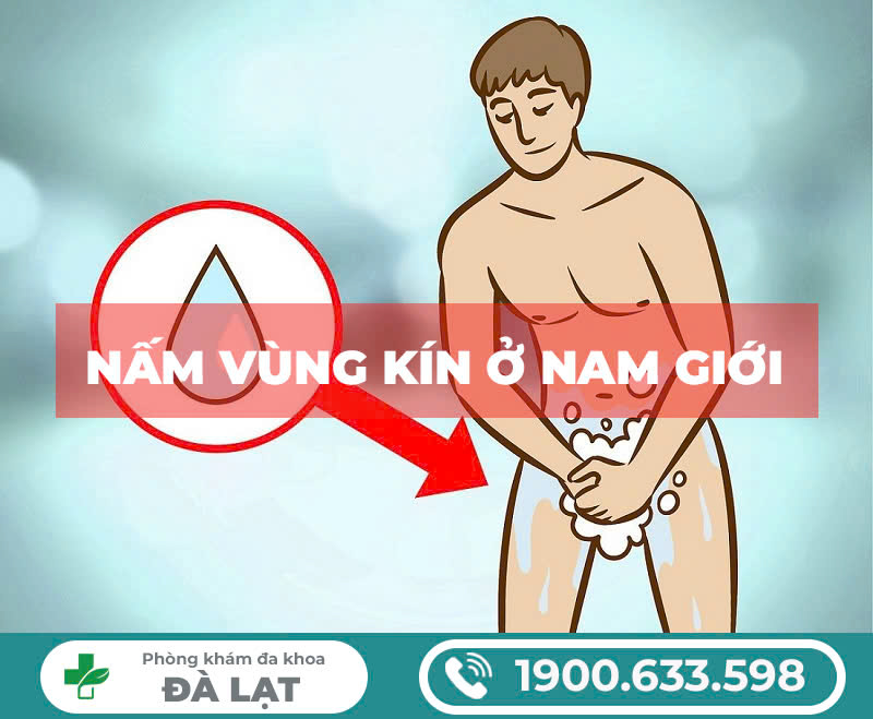 Hình ảnh minh họa